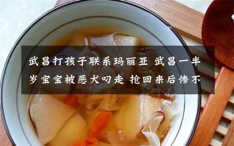 武昌打孩子联系玛丽亚 武昌一半岁宝宝被恶犬叼走 抢回来后惨不忍睹