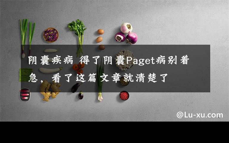 阴囊疾病 得了阴囊Paget病别着急,看了这篇文章就清楚了