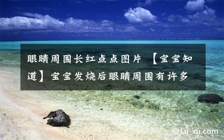 眼睛周围长红点点图片 【宝宝知道】宝宝发烧后眼睛周围有许多小红点怎么回事?