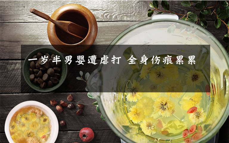 一岁半男婴遭虐打 全身伤痕累累