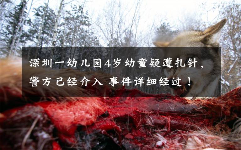 深圳一幼儿园4岁幼童疑遭扎针,警方已经介入 事件详细经过!