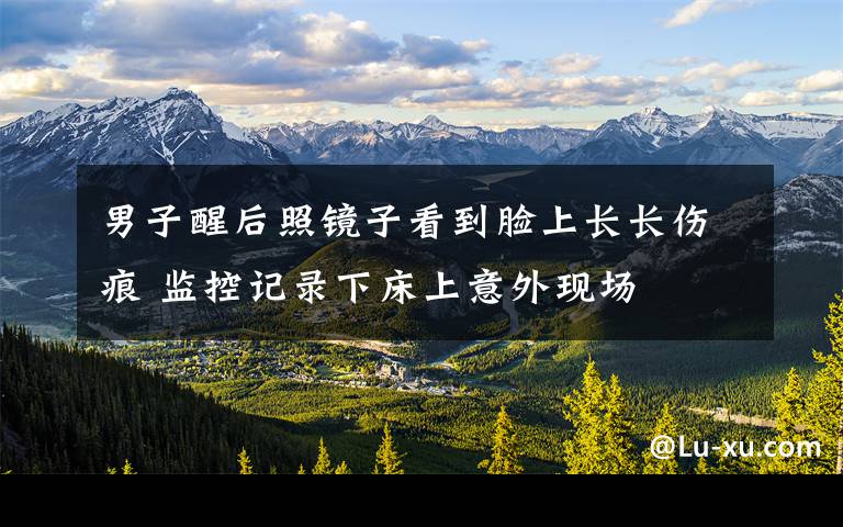 男子醒后照镜子看到脸上长长伤痕 监控记录下床上意外现场