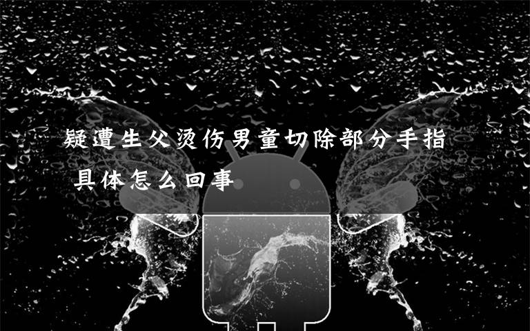 疑遭生父烫伤男童切除部分手指 具体怎么回事