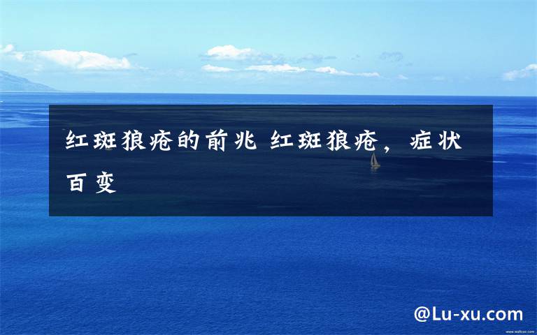 红斑狼疮的前兆 红斑狼疮,症状百变