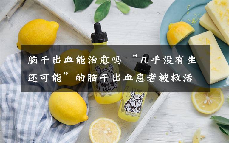 脑干出血能治愈吗 “几乎没有生还可能”的脑干出血患者被救活 重庆脑出血治疗有新突破