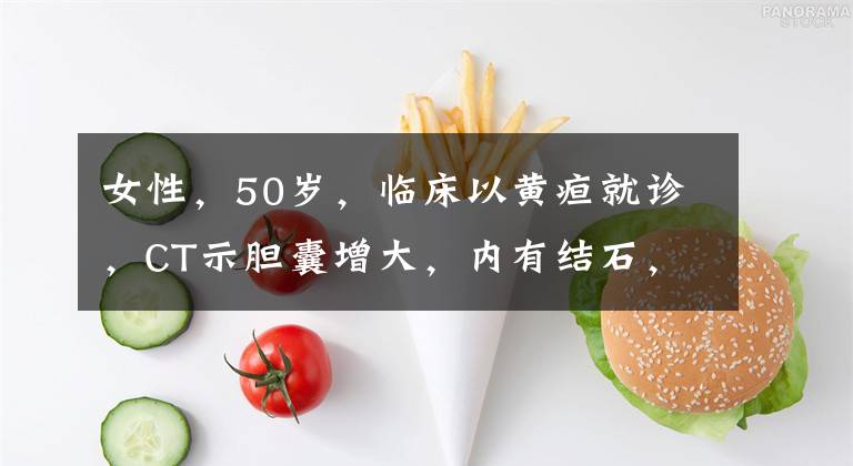 女性，50岁，临床以黄疸就诊，CT示胆囊增大，内有结石，胆总管扩张，在胰头段略细而突然中断，增强扫描见胆总管下段壁明显增厚且有强化，应考虑