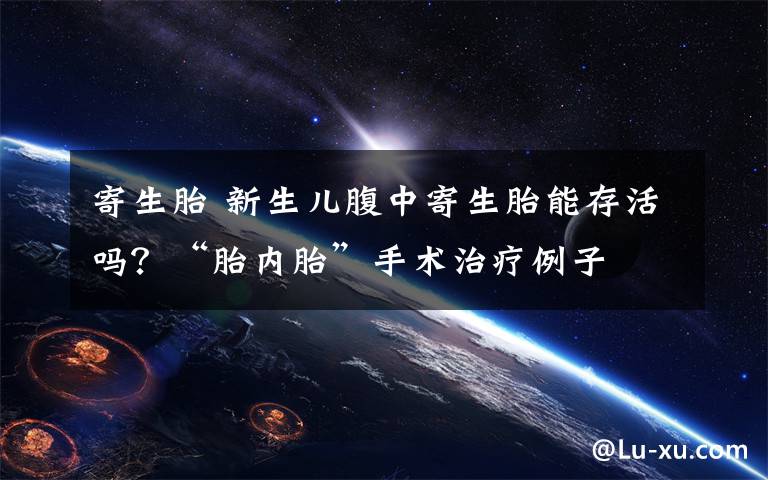 寄生胎 新生儿腹中寄生胎能存活吗？“胎内胎”手术治疗例子