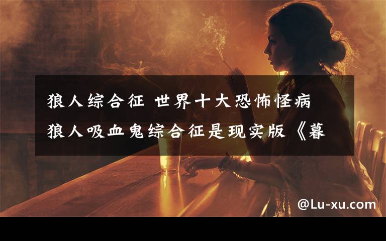 狼人综合征 世界十大恐怖怪病 狼人吸血鬼综合征是现实版《暮光之城》?