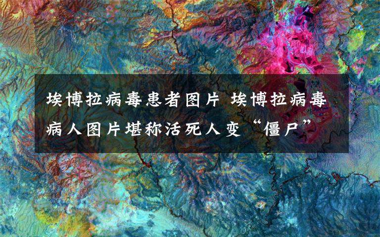埃博拉病毒患者图片 埃博拉病毒病人图片堪称活死人变“僵尸” 死者照片太恐怖尸体被拖上街头