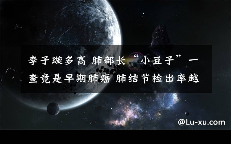 李子璇多高 肺部长“小豆子”一查竟是早期肺癌 肺结节检出率越来越高千万别不当回事
