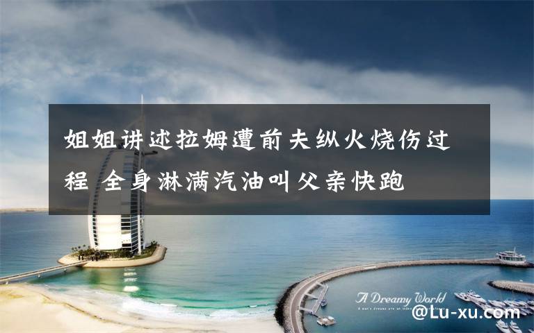 姐姐讲述拉姆遭前夫纵火烧伤过程 全身淋满汽油叫父亲快跑