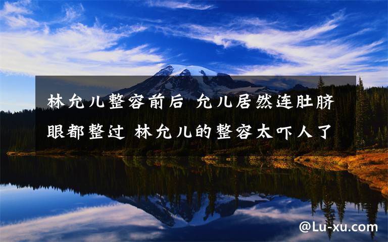 林允儿整容前后 允儿居然连肚脐眼都整过 林允儿的整容太吓人了!