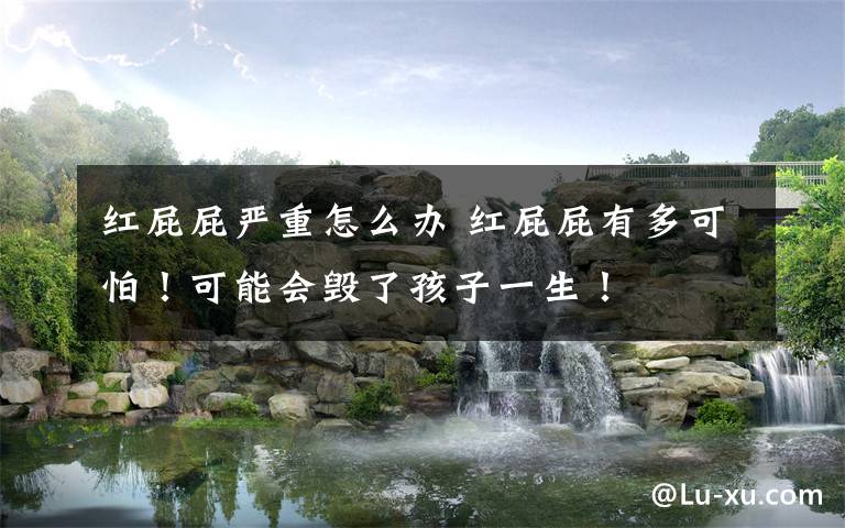 红屁屁严重怎么办 红屁屁有多可怕!可能会毁了孩子一生!