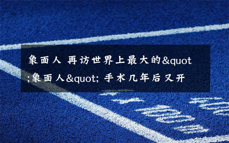 象面人 再访世界上最大的"象面人" 手术几年后又开始"发育"