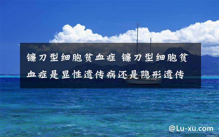 镰刀型细胞贫血症 镰刀型细胞贫血症是显性遗传病还是隐形遗传病?