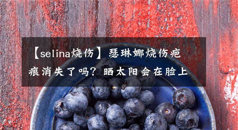 【selina烧伤】瑟琳娜烧伤疤痕消失了吗？晒太阳会在脸上产生不良的商家，征兵和征兵，消除伤疤。