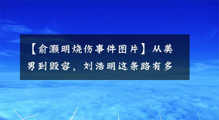 【俞灏明烧伤事件图片】从美男到毁容，刘浩明这条路有多难？