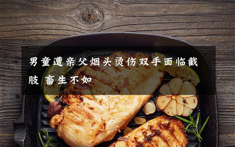 男童遭亲父烟头烫伤双手面临截肢 畜生不如