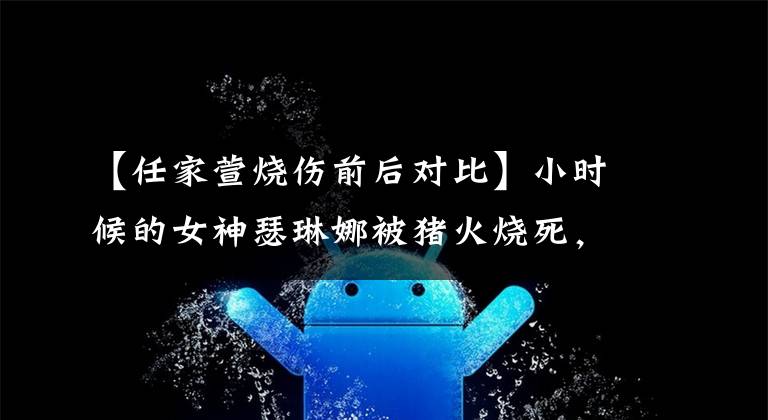 【任家萱烧伤前后对比】小时候的女神瑟琳娜被猪火烧死,在现场流泪,事故后参加马拉松,果断地展示了伤疤。
