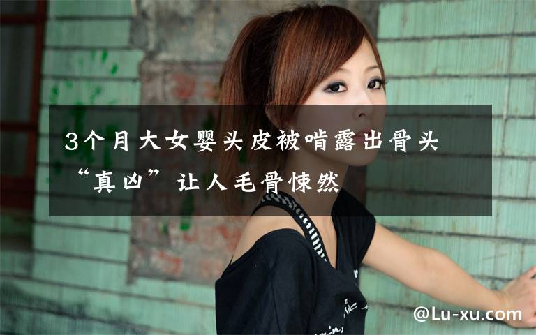 3个月大女婴头皮被啃露出骨头 “真凶”让人毛骨悚然