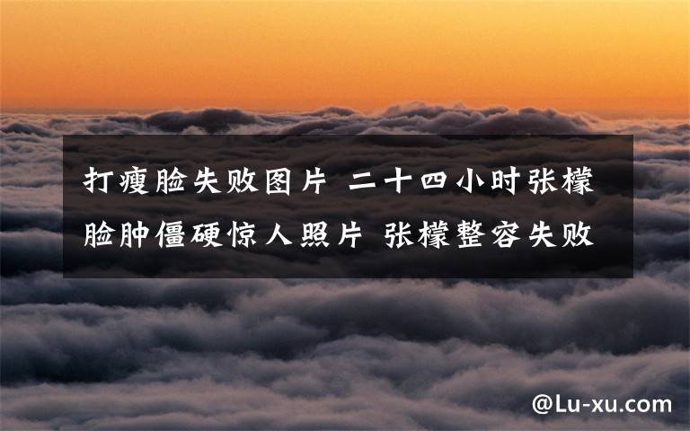 打瘦脸失败图片 二十四小时张檬脸肿僵硬惊人照片 张檬整容失败前后照片曝光
