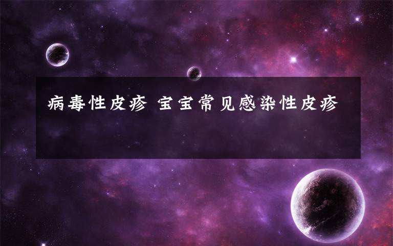 病毒性皮疹 宝宝常见感染性皮疹