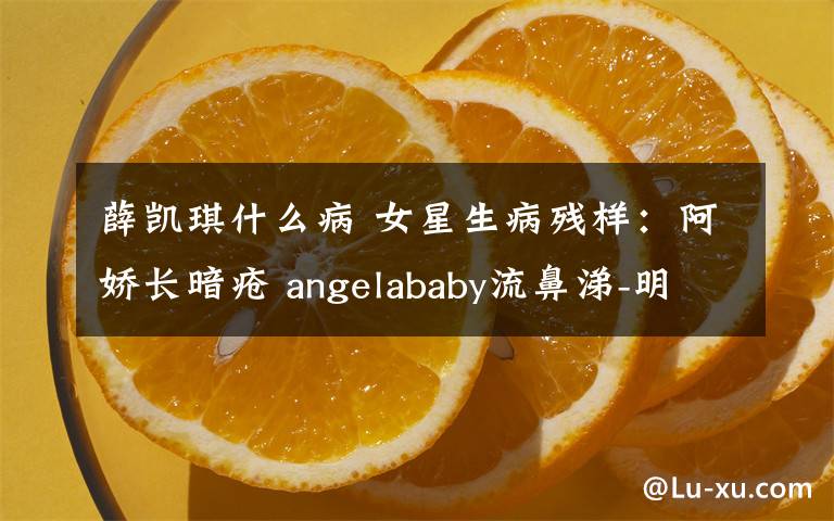 薛凯琪什么病 女星生病残样:阿娇长暗疮 angelababy流鼻涕-明星囧图- 东南网