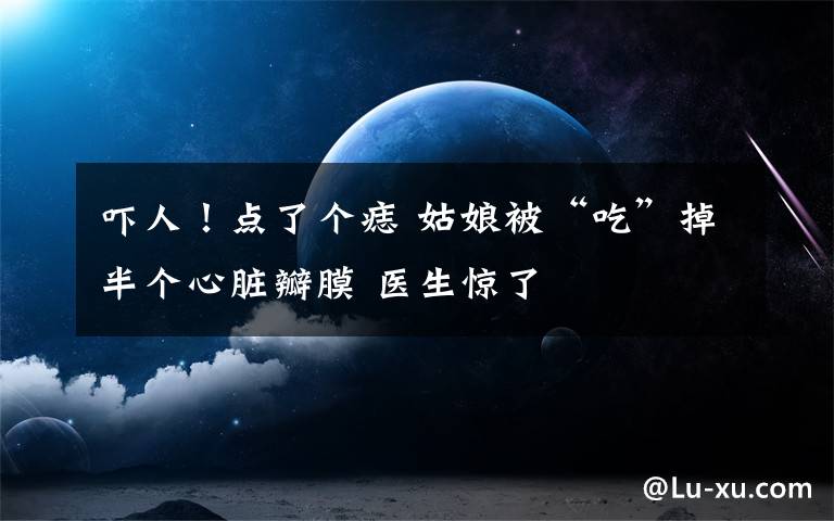 吓人!点了个痣 姑娘被“吃”掉半个心脏瓣膜 医生惊了