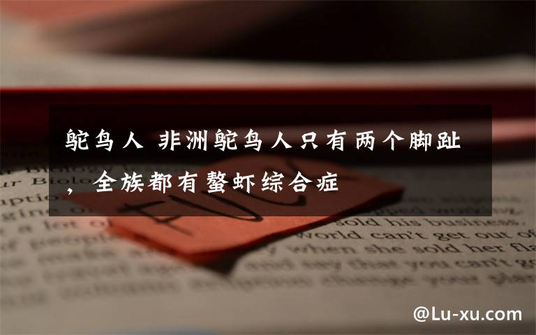 鸵鸟人 非洲鸵鸟人只有两个脚趾,全族都有螯虾综合症