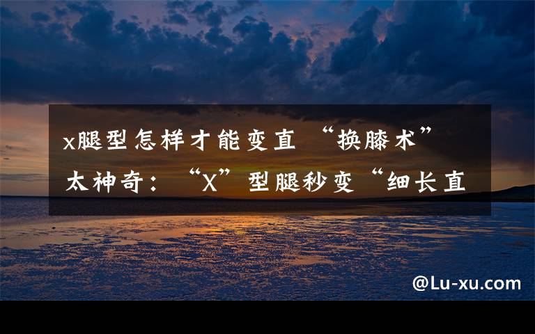 x腿型怎样才能变直 “换膝术”太神奇：“X”型腿秒变“细长直” 还原地长高7厘米