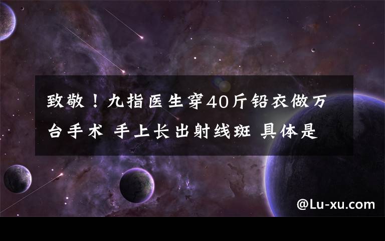 致敬！九指医生穿40斤铅衣做万台手术 手上长出射线斑 具体是什么情况？