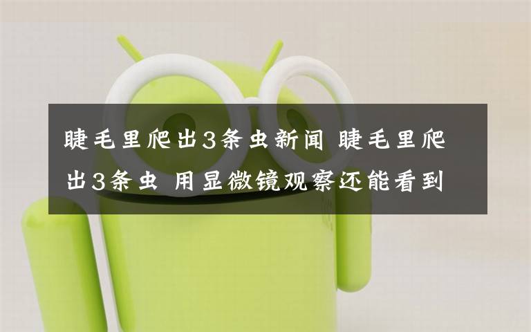 睫毛里爬出3条虫新闻 睫毛里爬出3条虫 用显微镜观察还能看到螨虫在缓缓爬动