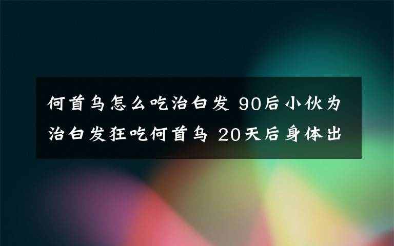 何首乌怎么吃治白发 90后小伙为治白发狂吃何首乌 20天后身体出现奇怪变化