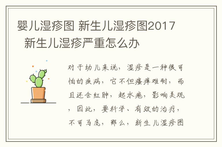 婴儿湿疹图 新生儿湿疹图2017 新生儿湿疹严重怎么办