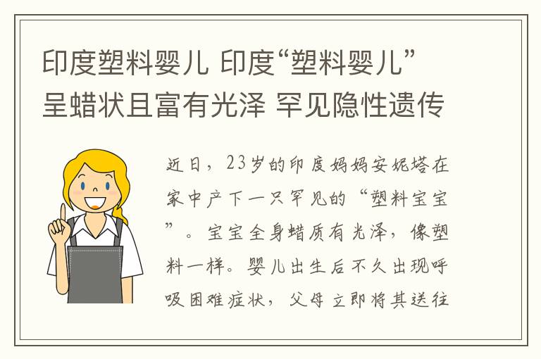 印度塑料婴儿 印度“塑料婴儿”呈蜡状且富有光泽 罕见隐性遗传病60万人中才一例