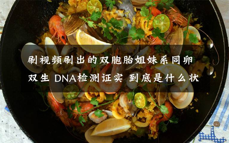 刷视频刷出的双胞胎姐妹系同卵双生 DNA检测证实 到底是什么状况?