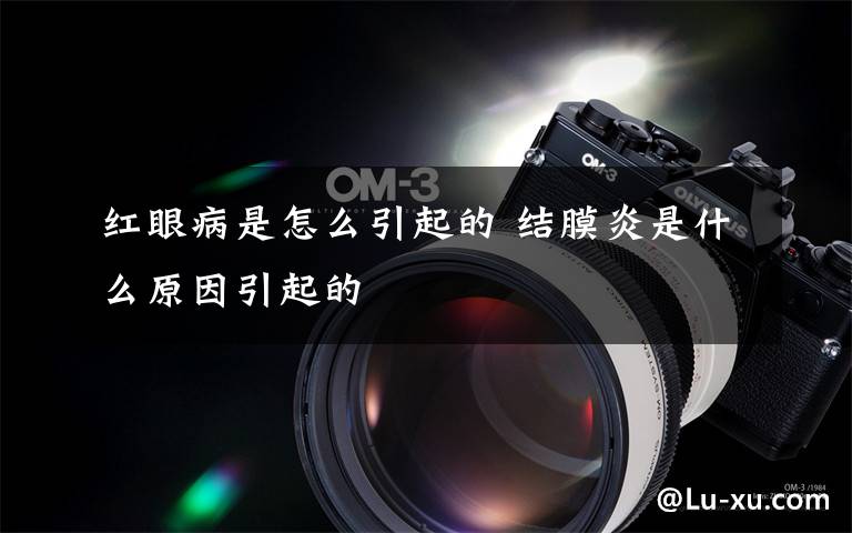 红眼病是怎么引起的 结膜炎是什么原因引起的