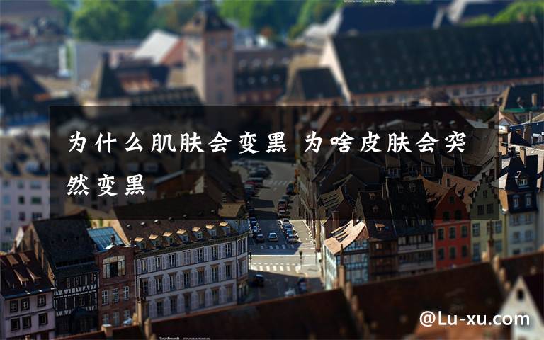 为什么肌肤会变黑 为啥皮肤会突然变黑