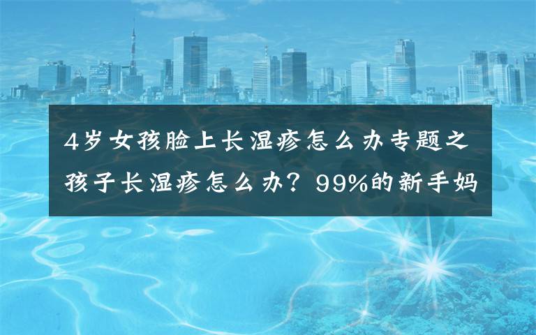 4岁女孩脸上长湿疹怎么办专题之孩子长湿疹怎么办?99%的新手妈妈都看过这篇文章。