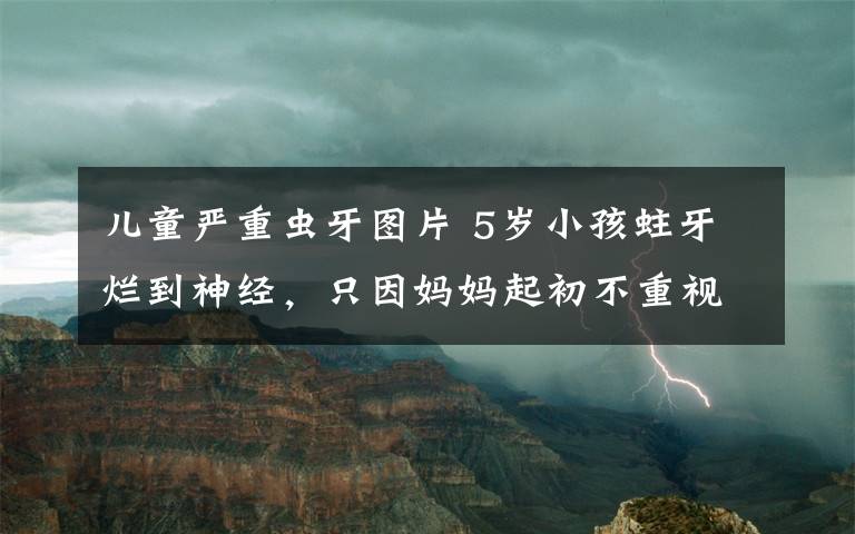 儿童严重虫牙图片 5岁小孩蛀牙烂到神经,只因妈妈起初不重视