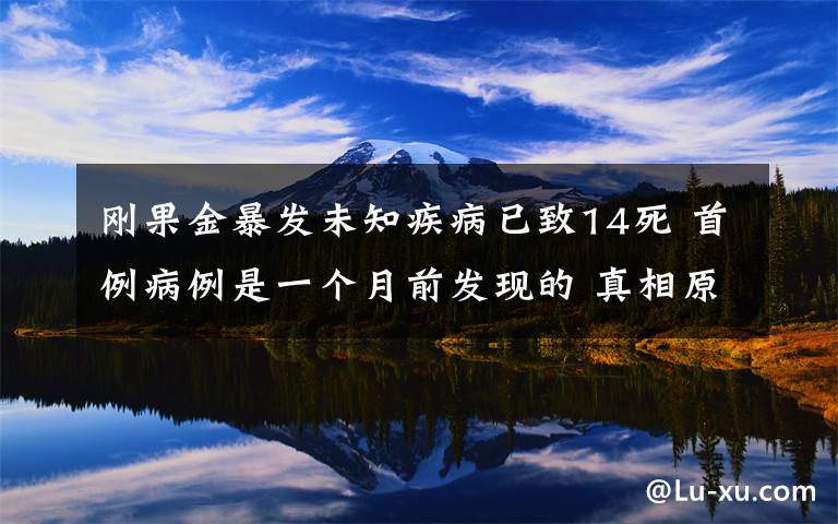 刚果金暴发未知疾病已致14死 首例病例是一个月前发现的 真相原来是这样!