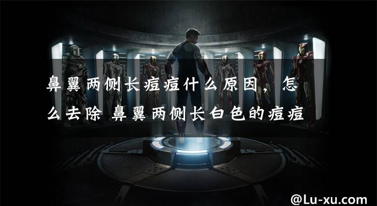 鼻翼两侧长痘痘什么原因，怎么去除 鼻翼两侧长白色的痘痘