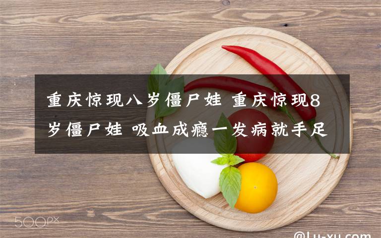 重庆惊现八岁僵尸娃 重庆惊现8岁僵尸娃 吸血成瘾一发病就手足僵硬嚷着要喝血