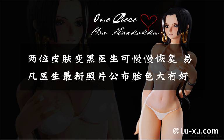 两位皮肤变黑医生可慢慢恢复 易凡医生最新照片公布脸色大有好转