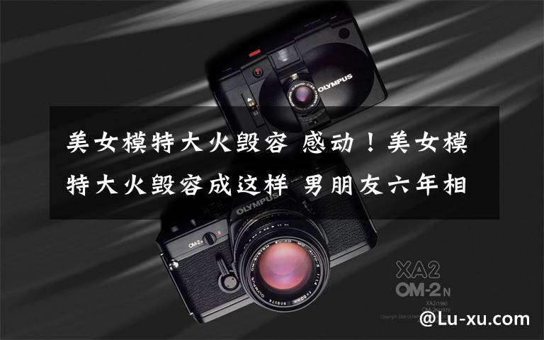 美女模特大火毁容 感动！美女模特大火毁容成这样 男朋友六年相守不离不弃