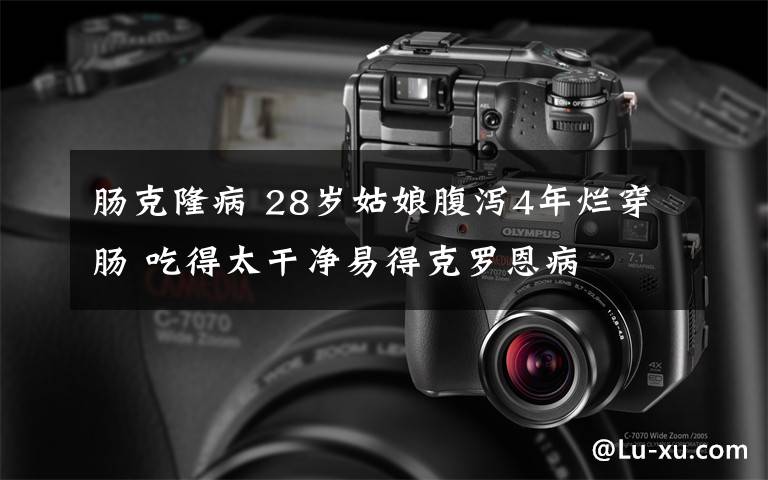 肠克隆病 28岁姑娘腹泻4年烂穿肠 吃得太干净易得克罗恩病