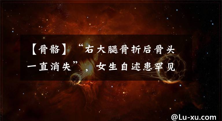 【骨骼】“右大腿骨折后骨头一直消失”,女生自述患罕见病多年无法找到病因