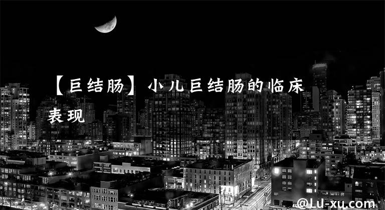 【巨结肠】小儿巨结肠的临床表现