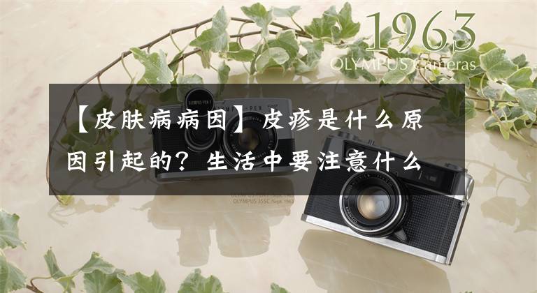 【皮肤病病因】皮疹是什么原因引起的？生活中要注意什么？