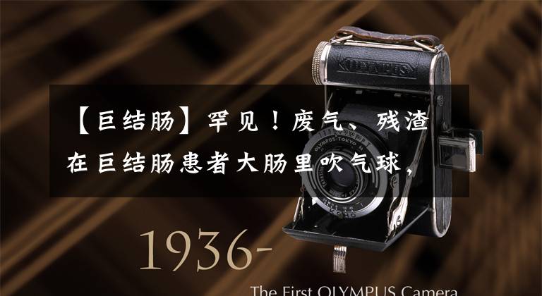 【巨结肠】罕见!废气、残渣在巨结肠患者大肠里吹气球,膨胀到几欲爆裂